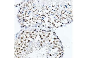 Immunohistochemistry (IHC) image for anti-Mdc1 (MDC1) (AA 1-100) antibody (ABIN6143659)