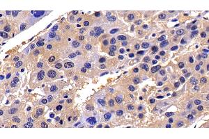 Immunohistochemistry (IHC) image for anti-Caspase 8 (CASP8) (AA 7-201) antibody (ABIN7444115)