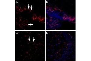 Expression of LPA4 receptor in rat and mouse brain - Immunohistochemical staining of rat choroid plexus and mouse hippocampal CA3 region using Anti-LPAR4 (P2Y9) (extracellular) Antibody (ABIN7043315, ABIN7044572 and ABIN7044573), (1:400). (LPAR4 Antikörper  (Extracellular))