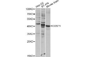 Western blot analysis of extracts of various cell lines, using DUSP1 Antibody (ABIN1872372) at 1:300 dilution. (DUSP1 Antikörper)