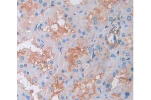 Used in DAB staining on fromalin fixed paraffin- embedded kidney tissue (Amyloid beta Precursor Protein Binding Protein 1 (AA 229-534) Antikörper)