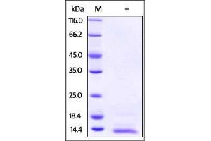 Human NRG4 on SDS-PAGE under reducing (R) condition. (Neuregulin 4 Protein (NRG4) (AA 2-62) (His tag))