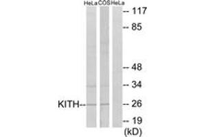 Western Blotting (WB) image for anti-Thymidine Kinase 1, Soluble (TK1) (AA 161-210) antibody (ABIN2889377) (TK1 Antikörper  (AA 161-210))