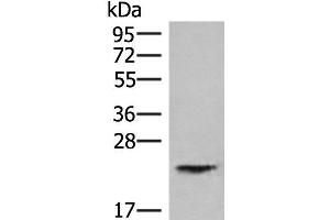 Western blot analysis of Human kidney tissue lysate using HEBP1 Polyclonal Antibody at dilution of 1:750 (HEBP1 Antikörper)