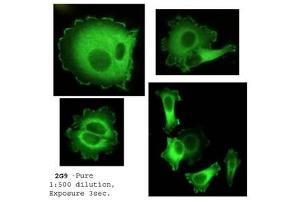 Immunofluorescence (IF) image for anti-Neural Precursor Cell Expressed, Developmentally Down-Regulated 9 (NEDD9) (AA 82-398) antibody (ABIN7278755) (NEDD9 Antikörper  (AA 82-398))