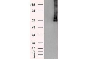 HEK293T cells were transfected with the pCMV6-ENTRY control (Left lane) or pCMV6-ENTRY PLK1 (Right lane) cDNA for 48 hrs and lysed. (PLK1 Antikörper)