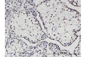 Immunoperoxidase of monoclonal antibody to TBX22 on formalin-fixed paraffin-embedded human placenta. (T-Box 22 Antikörper  (AA 431-519))