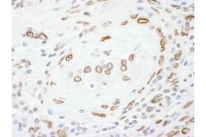 Immunohistochemistry (IHC) image for anti-Lamin A/C (LMNA) (AA 400-450) antibody (ABIN7455219) (Lamin A/C Antikörper  (AA 400-450))