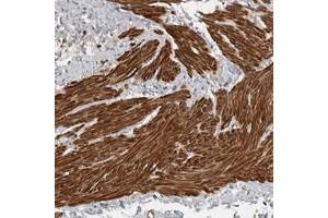 Immunohistochemical staining of human smooth muscle with C11orf48 polyclonal antibody  shows strong cytoplasmic positivity in smooth muscle cells. (C11orf48 Antikörper)