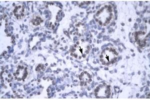 Rabbit Anti-YEATS4 Antibody  Paraffin Embedded Tissue: Human Lung Cellular Data: Alveolar cells Antibody Concentration: 4. (GAS41 Antikörper  (Middle Region))