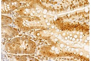 ABIN6257621 and ABIN6275320 at 1/100 staining Rat colon tissue by IHC-P.