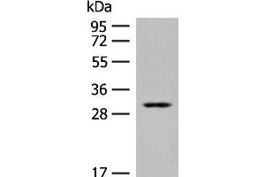 Western blot analysis of Human kidney tissue lysate using TPMT Polyclonal Antibody at dilution of 1:400