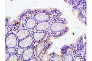 Immunohistochemistry (Paraffin-embedded Sections) (IHC (p)) image for anti-Interleukin-1 Receptor-Associated Kinase 1 (IRAK1) (pThr209) antibody (ABIN742658)
