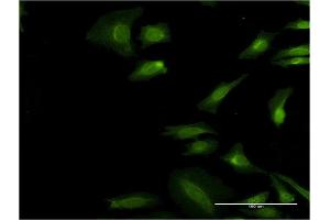 Immunofluorescence (IF) image for anti-Eukaryotic Translation Initiation Factor 3, Subunit I (EIF3I) (AA 226-325) antibody (ABIN522116)