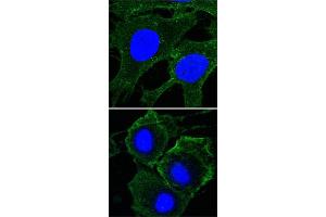 Confocal immunofluorescence analysis of HeLa (upper) and HepG2 (bottom) cells using KDR monoclonal antibody, clone 4B4  (green) . (VEGFR2/CD309 Antikörper)