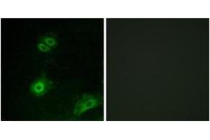 Immunofluorescence analysis of A549 cells, using OR4A16 Antibody. (OR4A16 Antikörper  (AA 261-310))