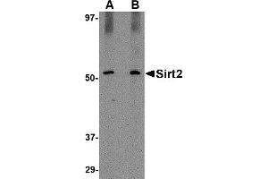 Western Blotting (WB) image for anti-Sirtuin 2 (SIRT2) (C-Term) antibody (ABIN1030664) (SIRT2 Antikörper  (C-Term))
