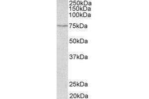 Western Blotting (WB) image for anti-Solute Carrier Family 6 (Neurotransmitter Transporter, serotonin), Member 4 (SLC6A4) (C-Term) antibody (ABIN2465034) (SLC6A4 Antikörper  (C-Term))
