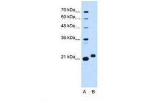 Image no. 1 for anti-Chromosome 1 Open Reading Frame 159 (C1orf159) (AA 93-142) antibody (ABIN6738341) (C1orf159 Antikörper  (AA 93-142))