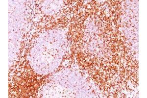 Image no. 2 for anti-CD6 (CD6) antibody (ABIN6160102) (CD6 Antikörper)