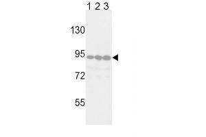Western blot analysis of TYRO10 Antibody in Jurkat (lane 1), 293 (lane 2) and Hela (lane 3) cell line lysates (35 ug/lane).