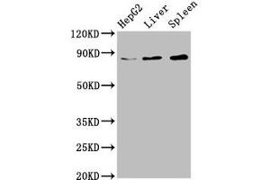 Western Blot Positive WB detected in: HepG2 whole cell lysate, Rat liver tissue, Mouse spleen tissue All lanes: NSUN2 antibody at 6. (NSUN2 Antikörper  (AA 432-509))
