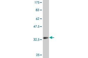 Western Blot detection against Immunogen (32. (DECR2 Antikörper  (AA 49-109))