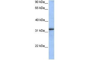 ETFA antibody used at 1 ug/ml to detect target protein. (ETFA Antikörper)