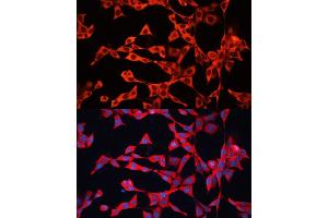 Immunofluorescence analysis of NIH/3T3 cells using GDI2 antibody (ABIN6129647, ABIN6141048, ABIN6141049 and ABIN7101828) at dilution of 1:100. (GDI2 Antikörper  (AA 296-445))