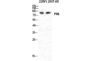 Western Blot (WB) analysis of specific cells using PML Polyclonal Antibody. (PML Antikörper  (N-Term))
