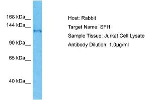 Host: Rabbit Target Name: SFI1 Sample Type: Jurkat Whole Cell lysates Antibody Dilution: 1. (SFI1 Antikörper  (C-Term))