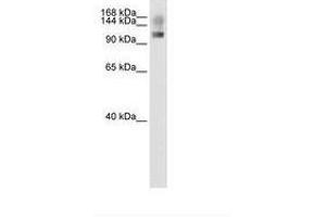 Image no. 1 for anti-Splicing Factor, Suppressor of White-Apricot Homolog (SFSWAP) (N-Term) antibody (ABIN204961) (SFRS8 Antikörper  (N-Term))