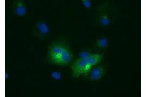 Anti-LIPG mouse monoclonal antibody (ABIN2453246) immunofluorescent staining of COS7 cells transiently transfected by pCMV6-ENTRY LIPG (RC209248). (LIPG Antikörper)