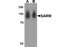 Western blot analysis of SARM in human kidney tissue lysate with SARM antibody at (A) 1 and (B) 2 µg/mL. (SARM1 Antikörper  (N-Term))