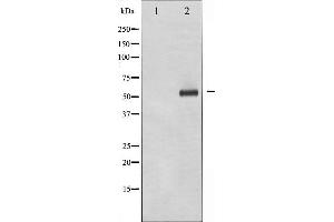 Western blot analysis of p56 Dok-2 phosphorylation expression in K562 whole cell lysates,The lane on the left is treated with the antigen-specific peptide. (DOK2 Antikörper  (pTyr299))