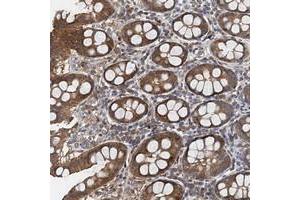 Immunohistochemical staining of human colon with PPP1R14D polyclonal antibody  shows moderate cytoplasmic positivity in glandular cells.