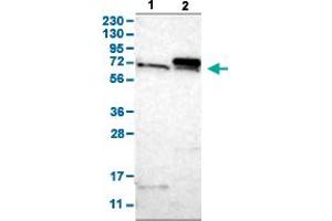 Western Blot analysis with TOMM70A polyclonal antibody . (TOM70 Antikörper  (AA 383-512))