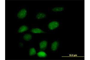 Immunofluorescence of purified MaxPab antibody to ZNF157 on HeLa cell. (ZNF157 Antikörper  (AA 1-506))