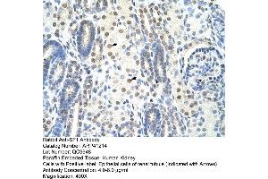 Rabbit Anti-SF1 Antibody  Paraffin Embedded Tissue: Human Kidney Cellular Data: Epithelial cells of renal tubule Antibody Concentration: 4. (Splicing Factor 1 Antikörper  (N-Term))