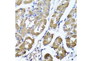 Immunohistochemistry of paraffin-embedded human stomach using HYAL1 antibody (ABIN5975045) at dilution of 1/100 (40x lens). (HYAL1 Antikörper)