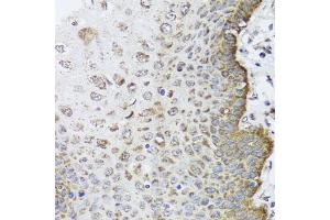 Immunohistochemistry of paraffin-embedded human esophagus using FANCL antibody (ABIN5995461) at dilution of 1/100 (40x lens). (FANCL Antikörper)