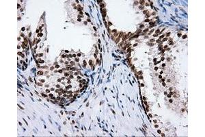 Immunohistochemical staining of paraffin-embedded Kidney tissue using anti-RC204952 mouse monoclonal antibody. (XRCC1 Antikörper)