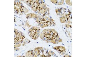 Immunohistochemistry of paraffin-embedded human stomach using CHIC2 antibody (ABIN6130103, ABIN6138533, ABIN6138534 and ABIN6223980) at dilution of 1:100 (40x lens). (CHIC2 Antikörper  (AA 1-165))