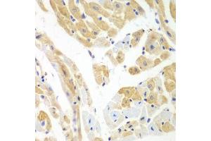 Immunohistochemistry of paraffin-embedded mouse heart using PCBP2 antibody (ABIN5971362) at dilution of 1/100 (40x lens).