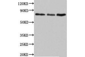 Western Blot Positive WB detected in: Jurkat whole cell lysate, Rat lung tissue, Mouse liver tissue All lanes: SUN2 antibody at 4. (SUN2 Antikörper  (AA 45-155))
