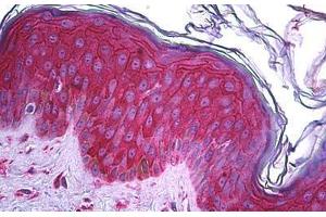 Human Skin: Formalin-Fixed, Paraffin-Embedded (FFPE) (KIT Antikörper  (AA 41-140))