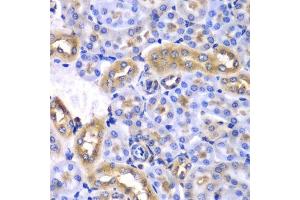 Immunohistochemistry (Paraffin-embedded Sections) (IHC (p)) image for anti-Synaptotagmin Binding, Cytoplasmic RNA Interacting Protein (SYNCRIP) (AA 1-200) antibody (ABIN6148764)
