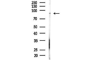 anti-FGFR1, FGFR2 antibody