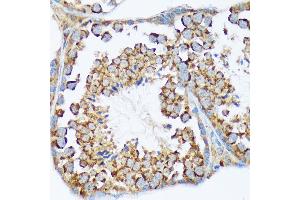 Immunohistochemistry of paraffin-embedded mouse testis using W/W/W Rabbit mAb (ABIN7271346) at dilution of 1:100 (40x lens). (WASF2 Antikörper)