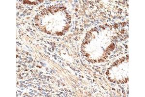 Immunohistochemistry of paraffin-embedded Human appendix using MCM5 Polyclonal Antibody at dilution of 1:100 (40x lens). (MCM5 Antikörper)